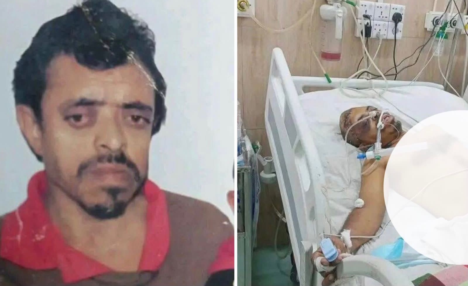 মাদারীপুরে সড়ক দুর্ঘটনার ১৯ দিন পর যুবকের মৃত্যু