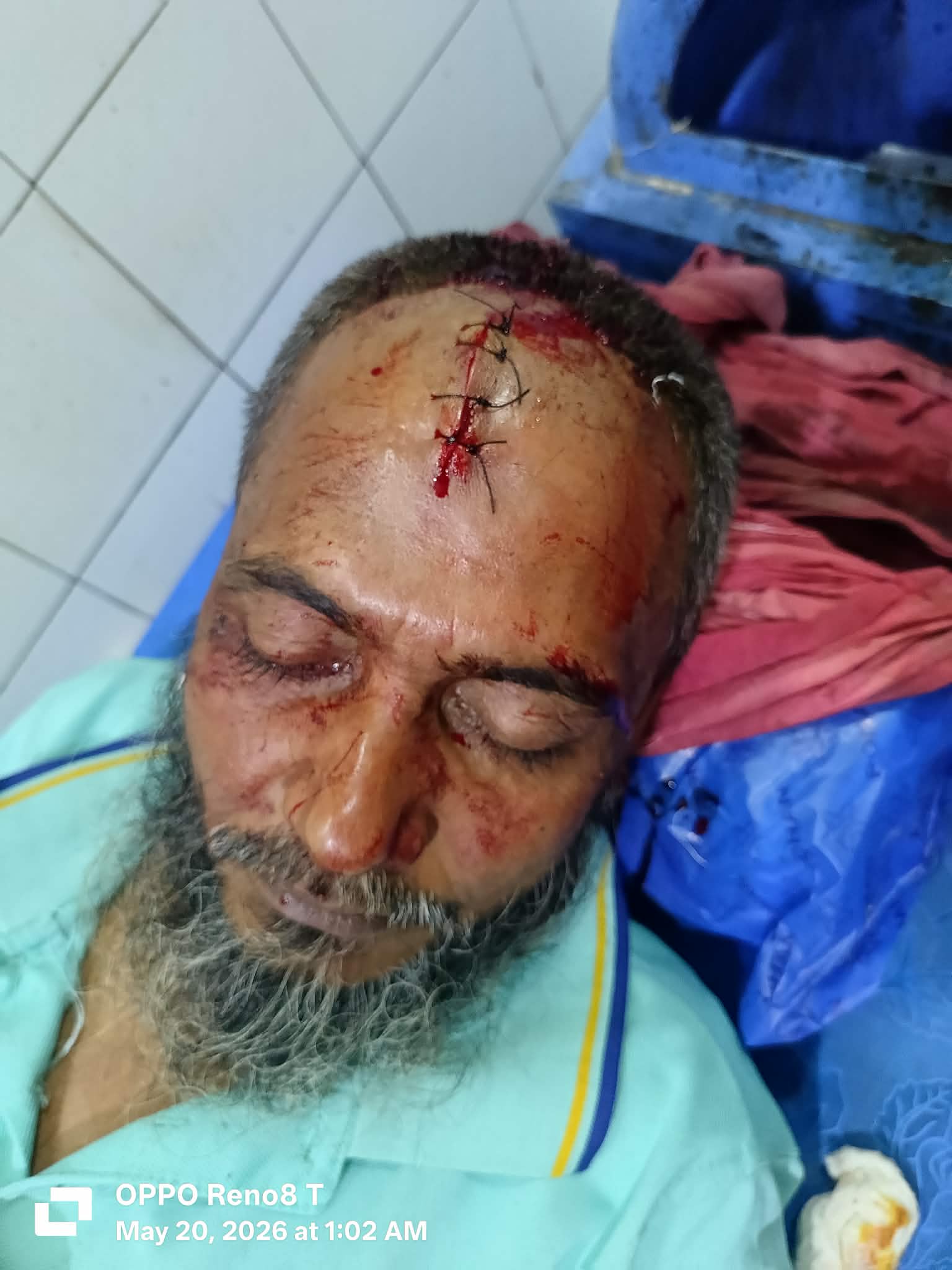 মাদক সম্রাট কে মাদক বিক্রি বাদাদেওয়াই বাড়িতে হামলা, কুপিয়ে জখম ও লুটপাটের অভিযোগ