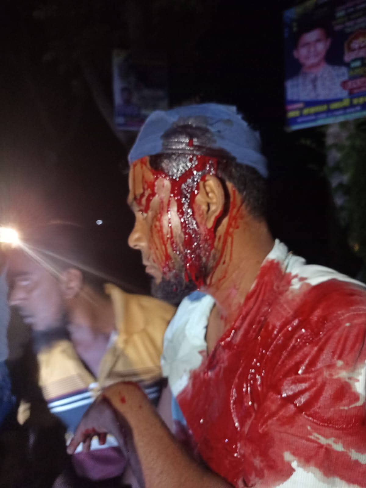 ভাঙ্গুড়ায় জামায়াত নেতা কুপিয়ে হত্যাচেষ্টার অভিযোগ থানা ঘেরাও ও বিক্ষোভ