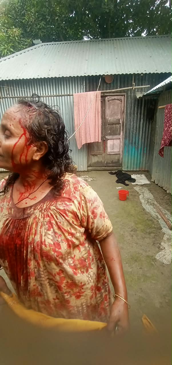 রায়গঞ্জে বাড়িতে ঢুকে মা-মেয়েকে মারধরের অভিযোগ